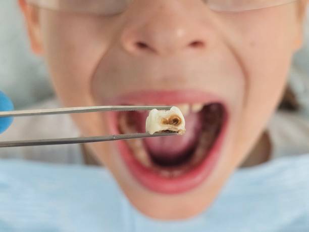 Best Mobile Emergency Dentist in Russell, GA
